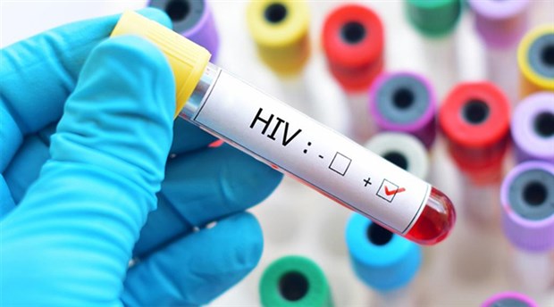 HIV ile Yaşamak Nasıl Bir Şey?