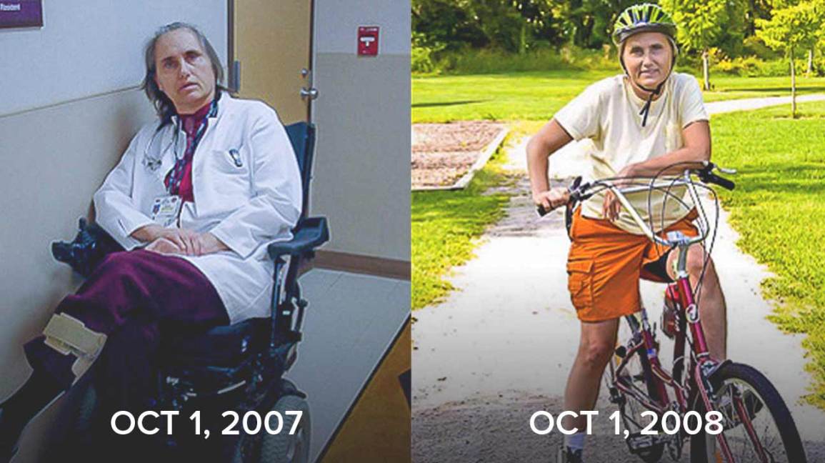 MS'li Bir Doktorun Tekerlekli Sandalyeden Yürümeye Uzanan Hikayesi