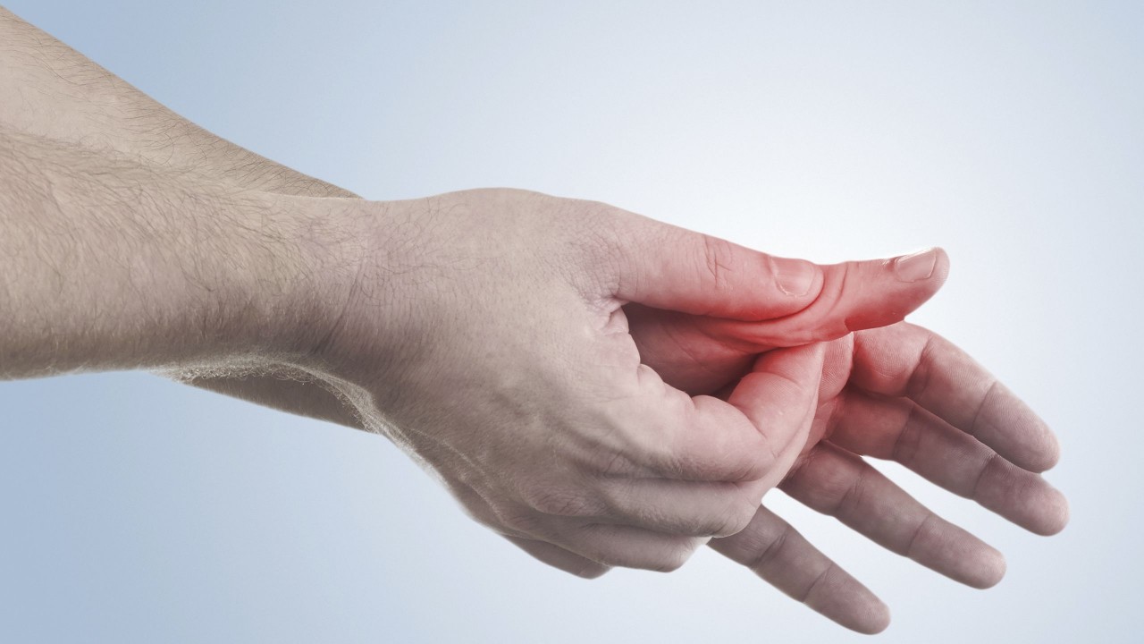 Psoriatik Artrit (Eklem Tutulması) Tedavisi