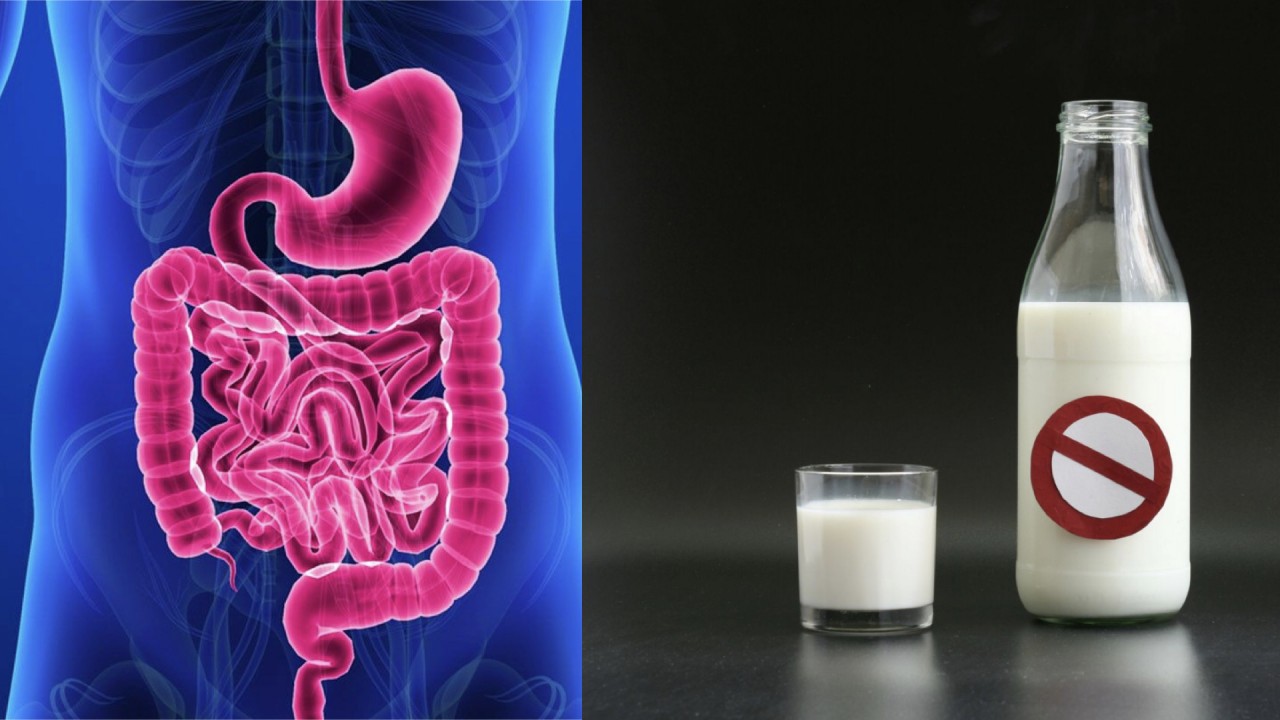 Crohn Hastalığı Ve Laktoz İntoleransı Arasındaki Fark