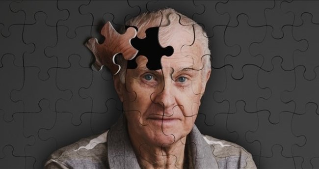 Alzheimer Hastalığı: Tanımı, Belirtileri ve Tedavi Seçenekleri